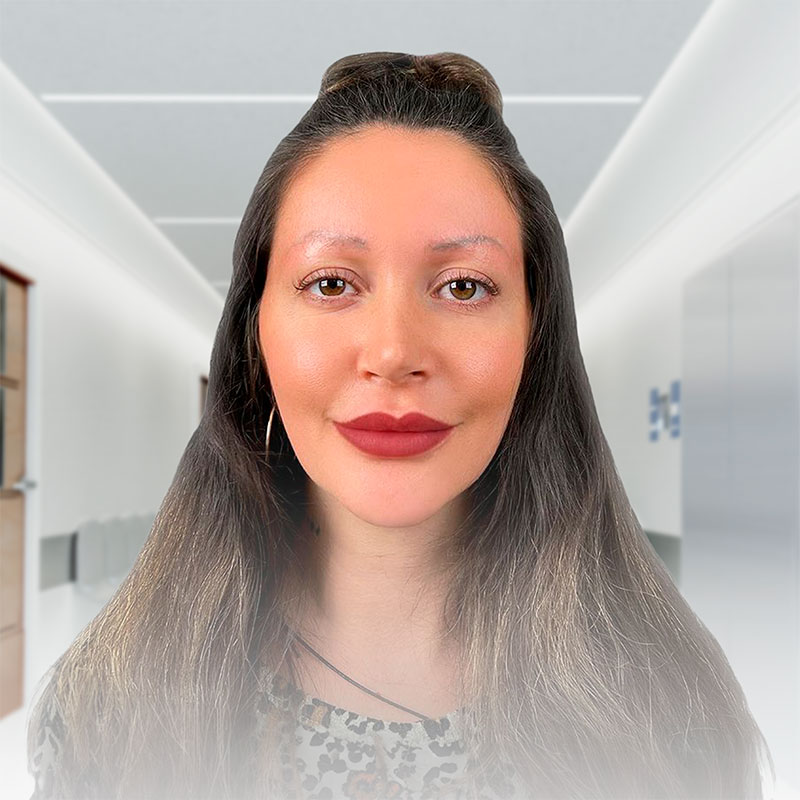 HOME 8 eyebrow transplant