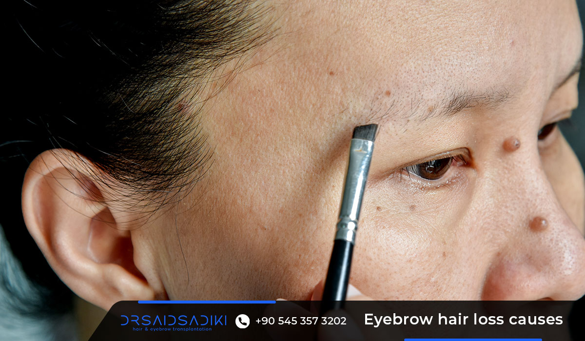 Eyebrow hair loss causes