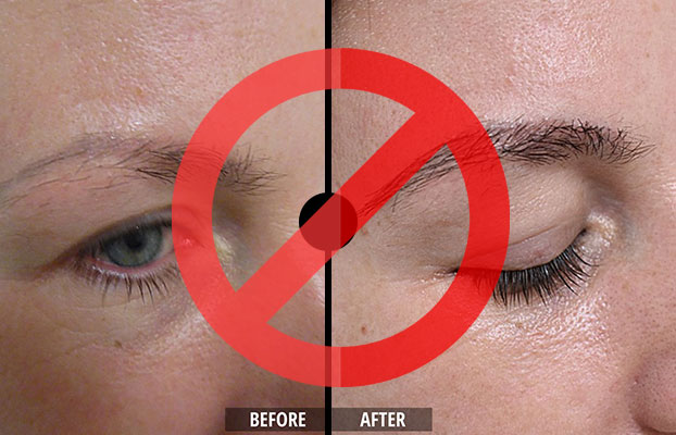 dhi-eyebrow-tranplant